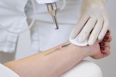 L'institut A Corps Parfait vous conseille pour choisir l'institut dans lequel retirer un tatouage