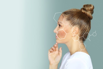 L'institut A Corps Parfait vous explique quels traitements utiliser en cas d'hyperpigmentation