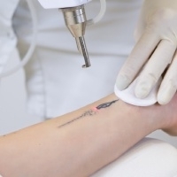 Conseils pour choisir un institut de confiance pour retirer un tatouage au laser