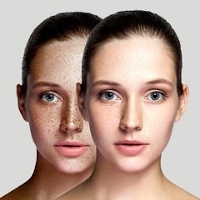 Comment éviter l’apparition de taches pigmentaires sur le visage