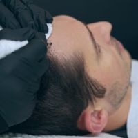 Est-ce que la micropigmentation capillaire est permanente ?